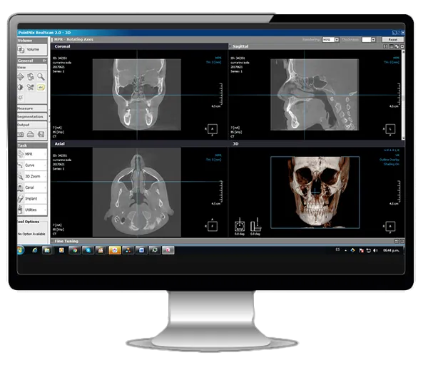 Software Real Scan con estudio de tomografía 3D